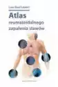 Atlas Reumatoidalnego Zapalenia Stawów