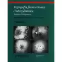  Angiografia Fluoresceinowa I Indocyjaninowa. Technika I Interpr