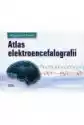 Atlas Elektroencefalografii