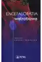 Encefalopatia Wątrobowa
