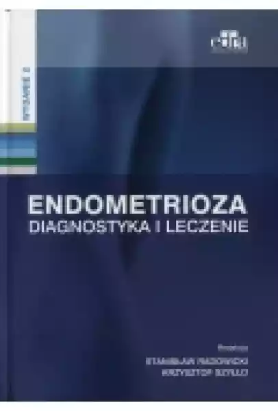 Endometrioza. Diagnostyka I Leczenie
