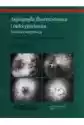 Angiografia Fluoresceinowa I Indocyjaninowa. Technika I Interpre