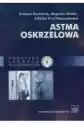 Astma Oskrzelowa